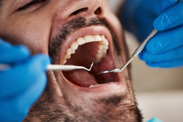 Best Emergency Treatment for Oral Infections in Lochsloy, WA